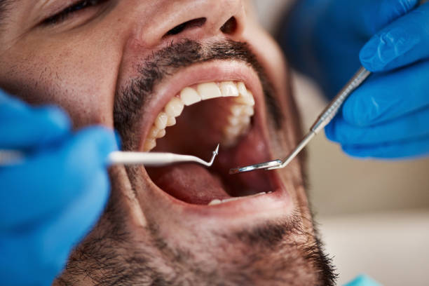 Best Dentist for Tooth Abscess  in Meeker, OK